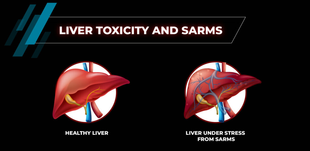 The Best Liver Support for SARMs in 2025